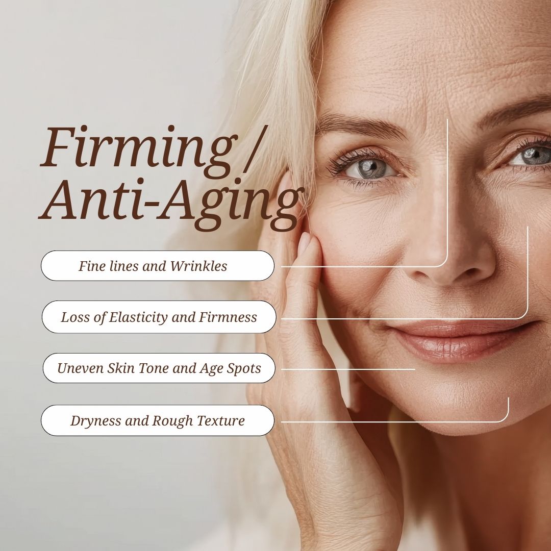 Σύσφιξη - Αντιγήρανση en